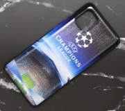 Чехол для Samsung Galaxy Note 10 Lite силиконовый лига чемпионов